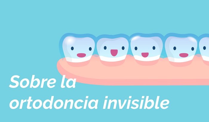 Ortodoncia Invisible Infantil